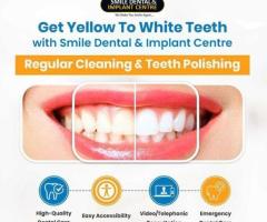Teeth Cleaning Price near me in AS Rao Nagar | Smile Dental & Implant Centre